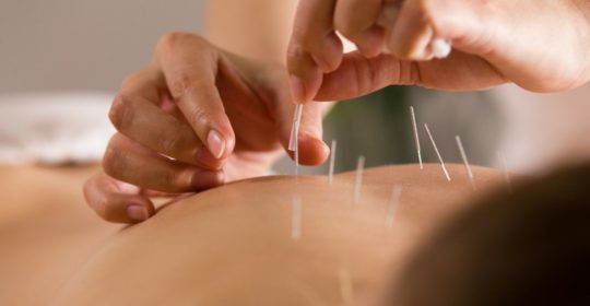 Standard Acupuncture and Chiropractic Treatment provider across New York City