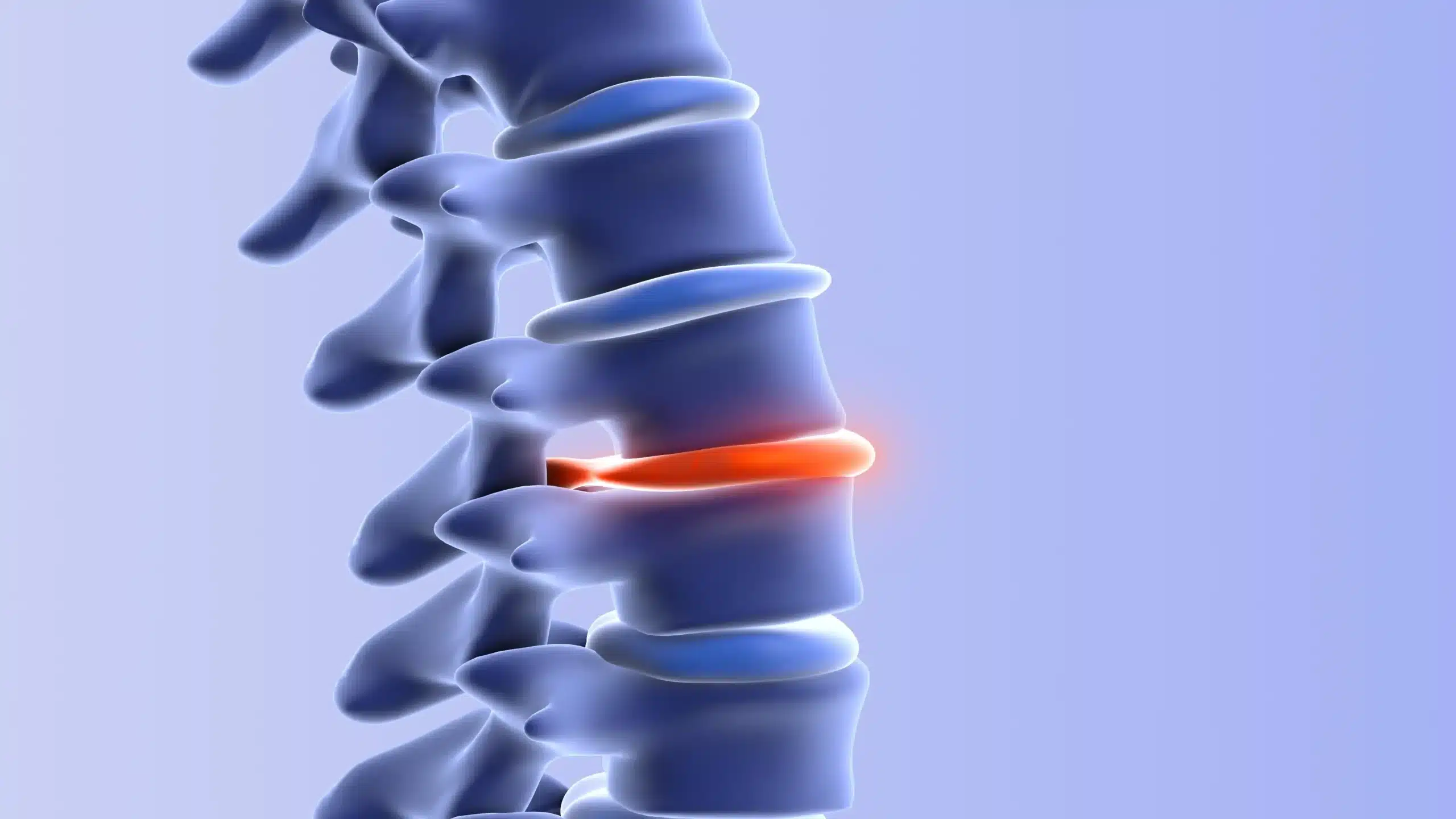 A chiropractor in Queens, NY, providing safe spinal adjustment for a herniated disc after a car accident at Bayside Physical Therapy, Chiropractic & Acupuncture, PLLC.